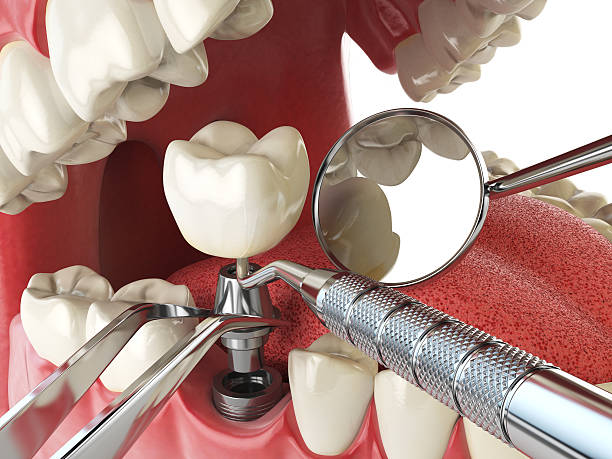 Best Emergency Treatment for Oral Infections in Mendota Heights, MN